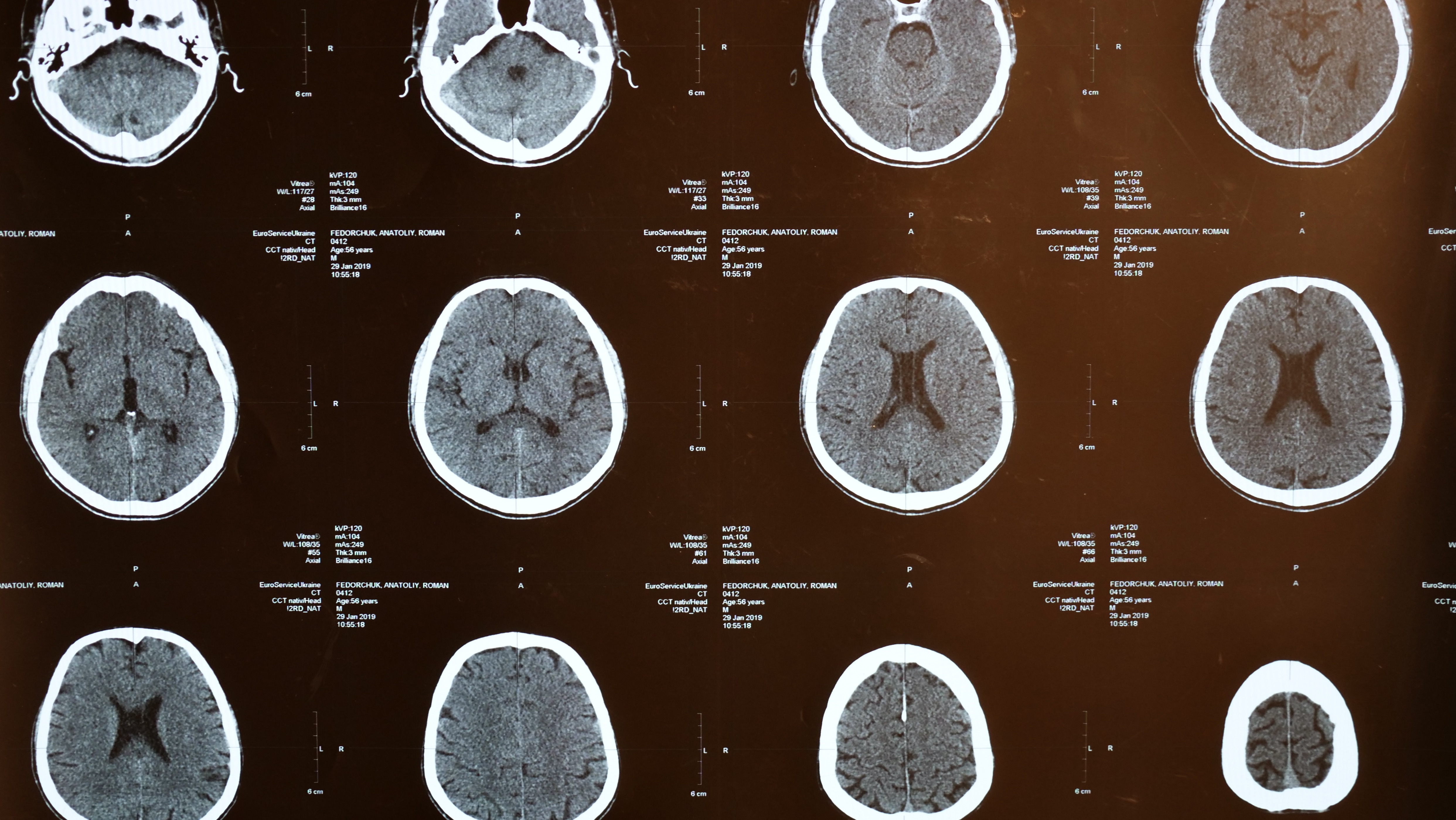 MRI film contact sheet
