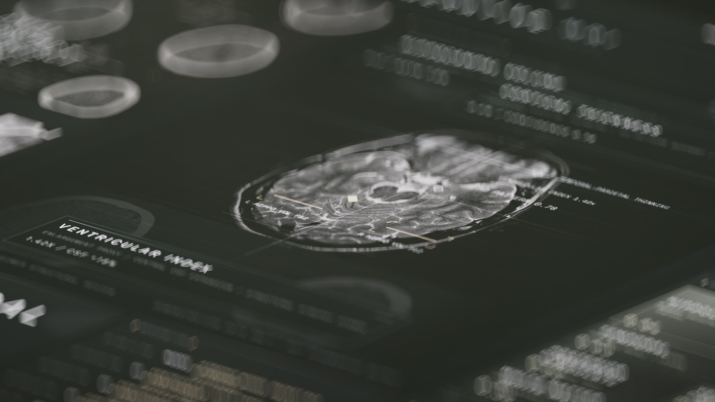 Neurodegenerative MRI Interface